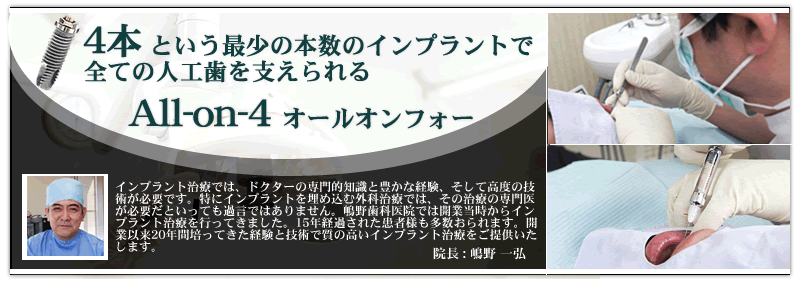 4本という最少の本数のインプラントで全ての人工歯を支えられる、All-on-4（オールオンフォー）｜インプラント治療では、ドクターの専門的知識と豊かな経験、そして高度の技術が必要です。特にインプラントを埋め込む外科治療では、その治療の専門医が必要だといっても過言ではありません。嶋野歯科医院では開業当時からインプラント治療を行ってきました。15年経過された患者様も多数おられます。開業以来20年間培ってきた経験と技術で質の高いインプラント治療をご提供いたします。